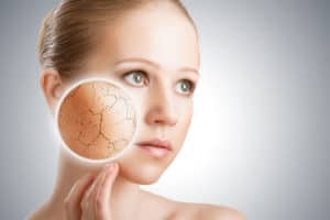 Read more about the article What Vitamins Will Help with Dry Skin?