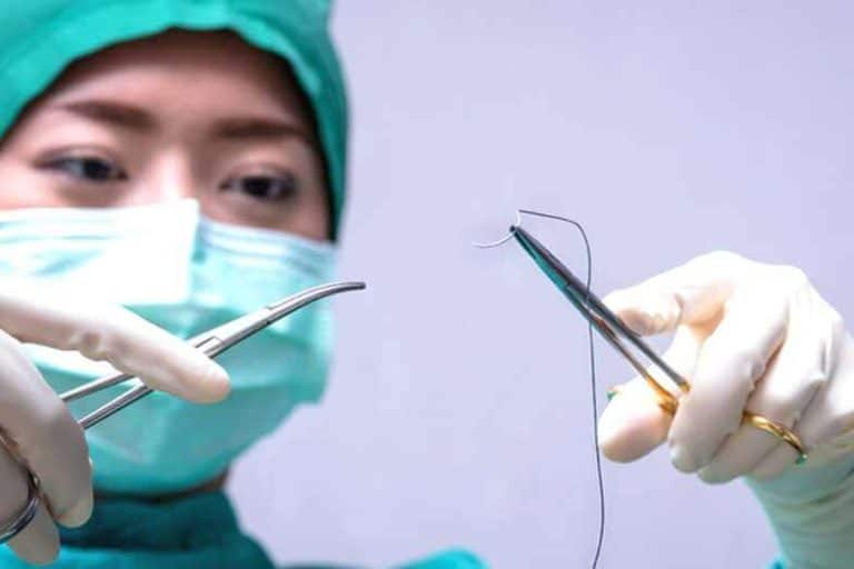 How Long Should Stitches Stay in Face? Skin Care Geeks