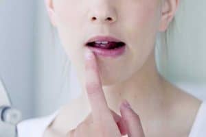 Read more about the article Dry Skin Above Upper Lip: Causes and Treatments