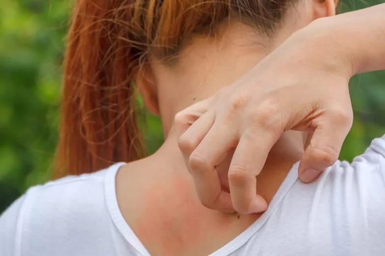 How Long Do Bug Bites Last on Skin?