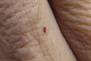 Read more about the article How Long Do Chiggers Live on Your Skin?